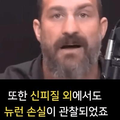 술 1잔이 뇌에 끼치는 영향 ㄷㄷ