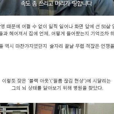 50대 애주가의 뇌 상태.jpg