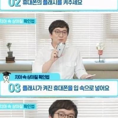 치아가 누래지는 이유.